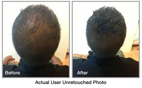 fibolica before and after photo 5