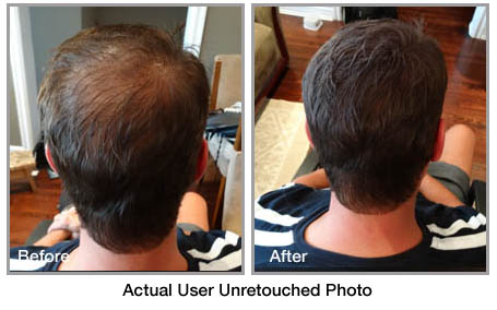 fibolica before and after photo 7