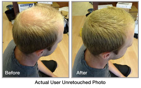 fibolica before and after photo 6