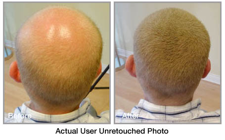 fibolica before and after photo 4