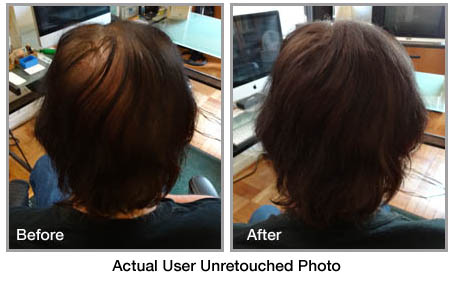 fibolica before and after photo 2