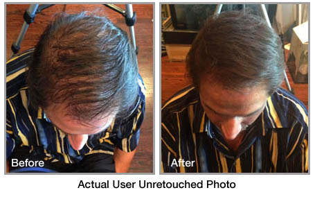 fibolica before and after photo 3