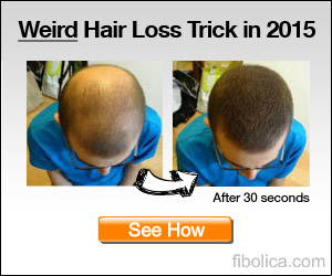 300 x 250 fibolica banner