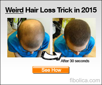 336 x 280 fibolica banner